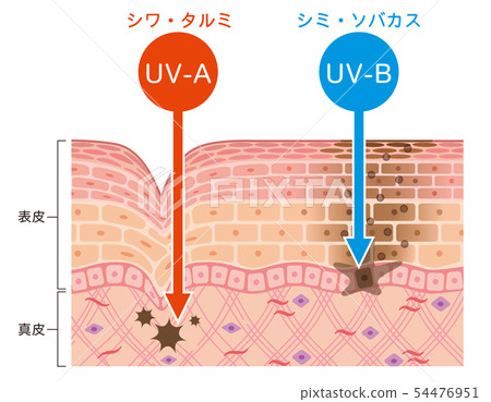 Skin figure UV damage - Stock Illustration [54476951] - PIXTA