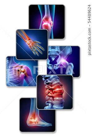 Human Joint Pain 54489624