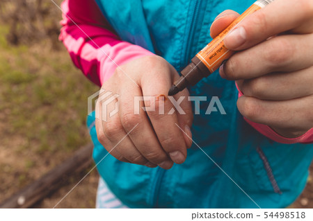 Injured hand with open cut, iodine-treated. 54498518