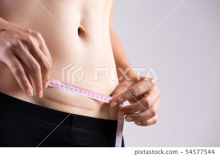 Closeup of woman showing on her belly dark scar Closeup of woman showing on her belly dark scar 54577544