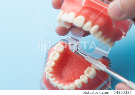 Dental cleaning 54593325