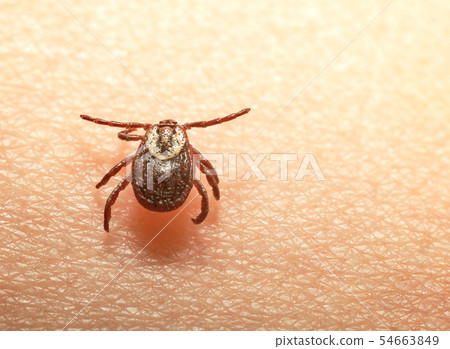 Tick on human skin 54663849