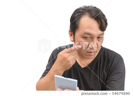 Man applying cream onto face with melasma Man applying cream onto face with melasma 54674890