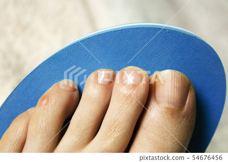 Toenail with fungus 54676456