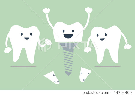 tooth and dental implants tooth and dental implants 54704409