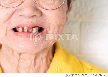 Asian Elderly woman over 70 years old be smile 54767657