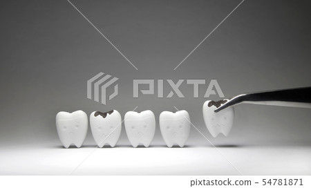 Decayed tooth model was pinch if don't brush teeth 54781871