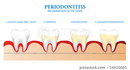 Educational poster about dental and gum health Tee 54810065