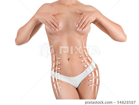 Woman marked out for cosmetic surgery. Liposuction concept, isolated on white background Woman marked out for cosmetic surgery. Liposuction concept, isolated on white background 54828587
