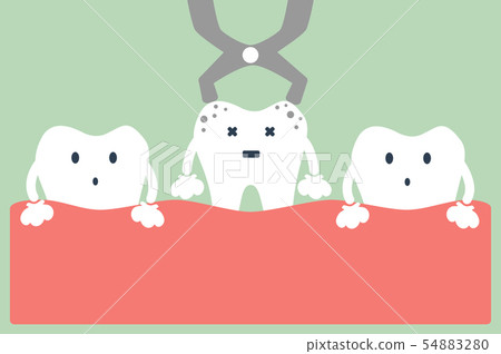 tooth extraction 54883280