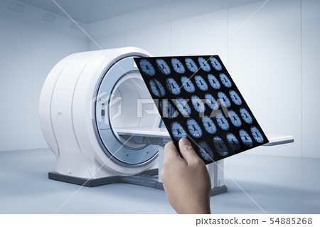 x-ray film with mri scan 54885268
