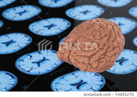 brain on x-ray background. brain on x-ray background. 54885278