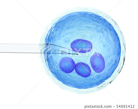 artificial insemination or ivf artificial insemination or ivf 54891412
