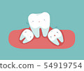 Wisdom tooth make tooth lose balance, dental  54919754