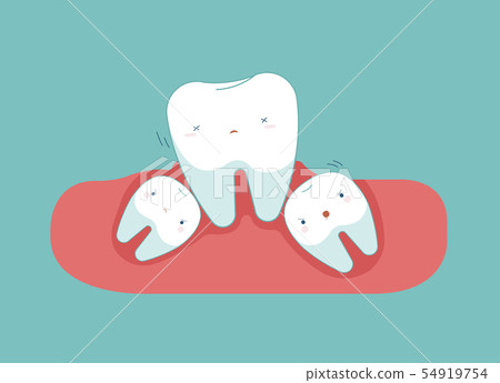 Wisdom tooth make tooth lose balance, dental  54919754