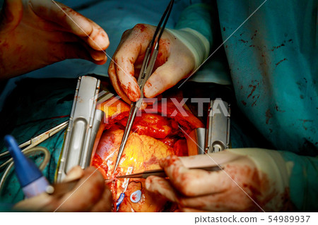 Surgeons working with a scissors on a patient Surgeons working with a scissors on a patient 54989937