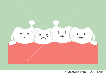 crowding teeth ( malocclusion ) 55081204