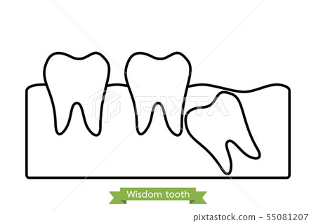 wisdom tooth 55081207