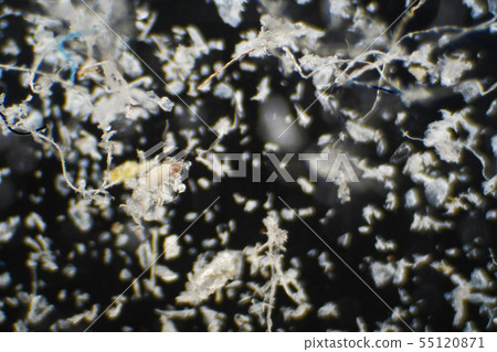 Corpus of house dust and ticks magnified by microscope 55120871