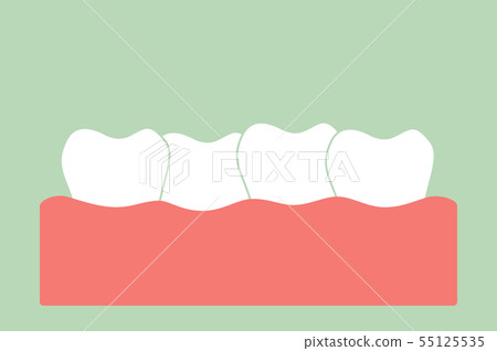 crowding teeth ( malocclusion ) 55125535
