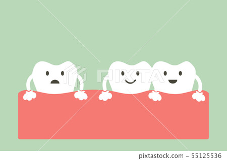 spacing teeth ( diastema ) spacing teeth ( diastema ) 55125536