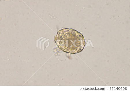 Ascaris lumbricoides egg in stool exam. 55140608