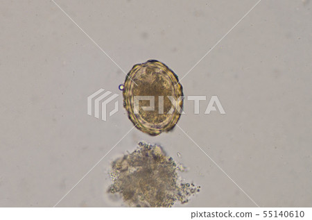 Ascaris lumbricoides egg in stool exam. 55140610