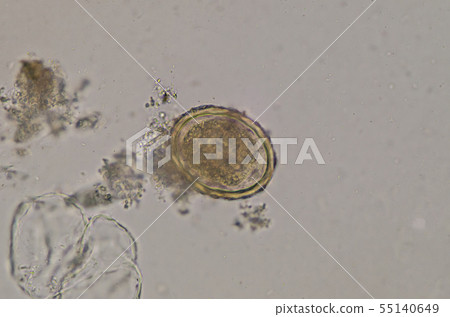 Ascaris lumbricoides egg in stool exam. 55140649