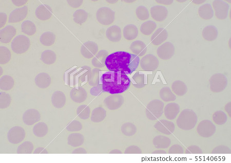 Blast cells on red blood cells background. 55140659