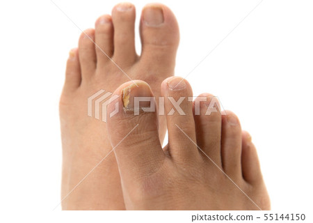 指甲運動員的腳 55144150