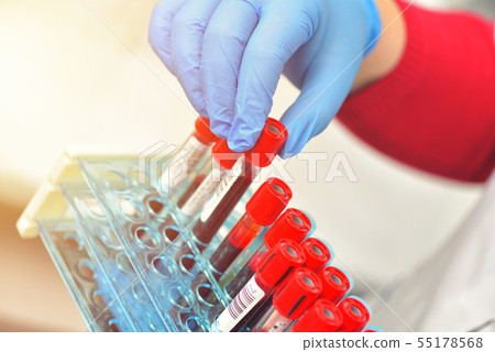 Tubes of blood sample for testing. Medical Tubes of blood sample for testing. Medical 55178568