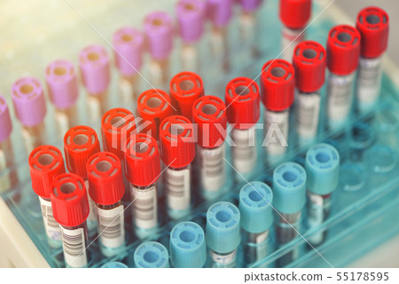 Tubes of blood sample for testing. Medical Tubes of blood sample for testing. Medical 55178595
