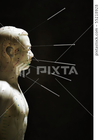Route anal anal fistula model acupuncture oriental medicine image Route anal anal fistula model acupuncture oriental medicine image 55218928
