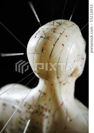 Route anal anal fistula model acupuncture oriental medicine image Route anal anal fistula model acupuncture oriental medicine image 55218933