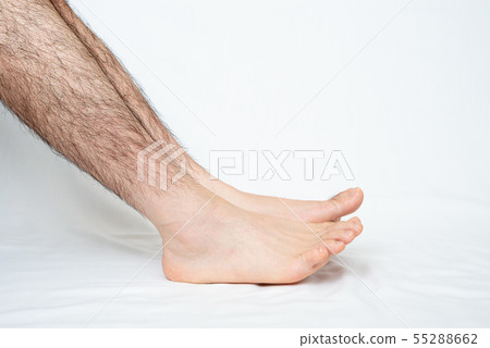Men's leg hair removal before image Men's leg hair removal before image 55288662