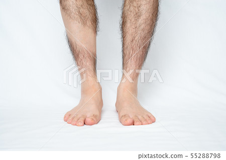 男士腿部脫髮 男士腿部脫髮 55288798