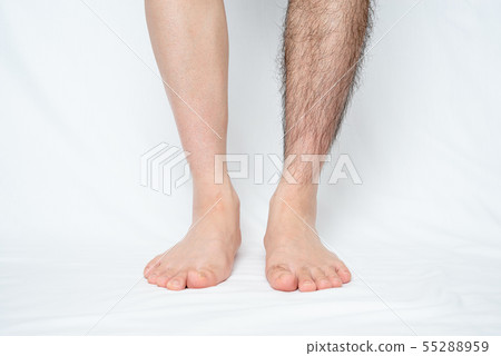 Men's Leg Hair Removal Before & After Image One Leg Only Men's Leg Hair Removal Before & After Image One Leg Only 55288959