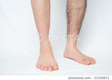 男士腿部脫毛前後圖像單腿 55288971