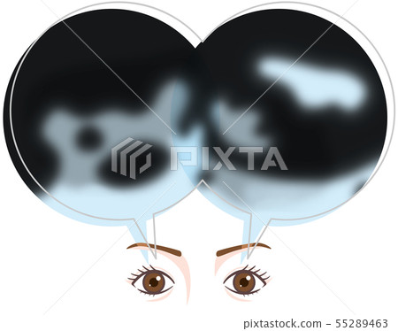 Eye symptoms 55289463