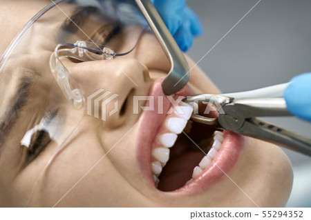 Pretty woman's teeth treatment in dental clinic Pretty woman's teeth treatment in dental clinic 55294352