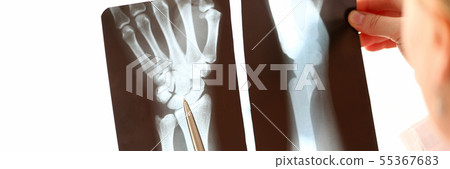 Doctor Female Hand Holding Hand Xray Photography 55367683
