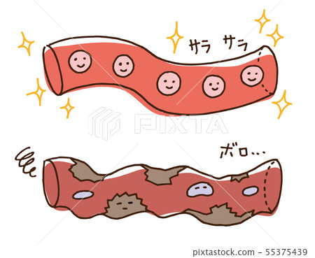 Healthy blood vessels rusted blood vessels - Stock Illustration ...