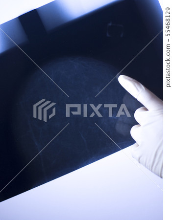 Xray breast scan mammogram 55468129