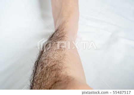 Men's leg hair removal before & after image one side only 55487517