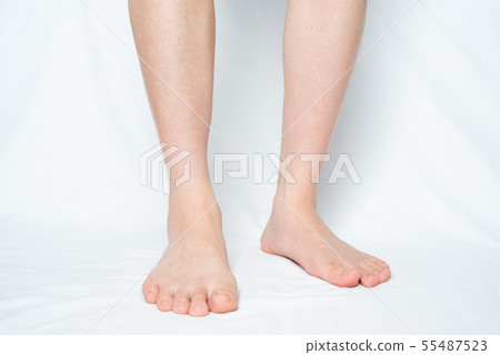 Men's Leg Hair Removal After Image Male Leg 55487523