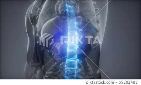 Backache in Back Bones Backache in Back Bones 55502483