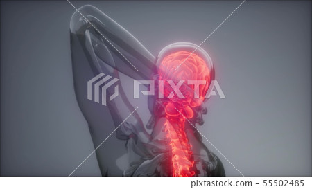 Backache in Back Bones Backache in Back Bones 55502485