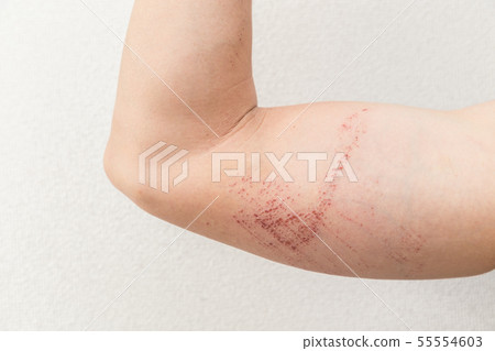 Scratch Scratch 55554603