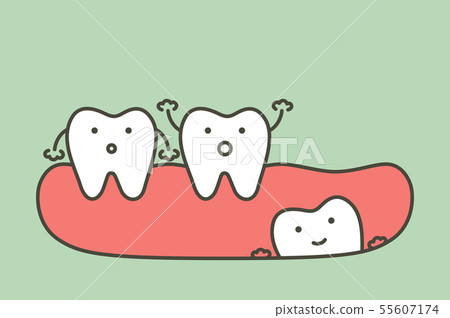 wisdom tooth ( angular or mesial impaction ) 55607174