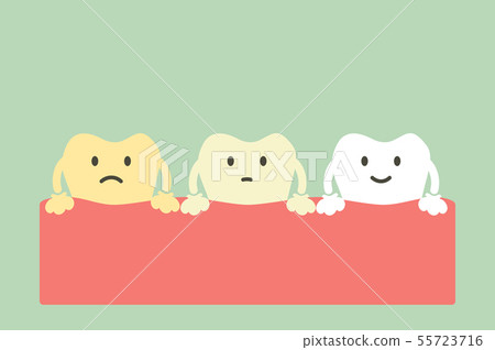 yellow to white tooth, teeth whitening concept yellow to white tooth, teeth whitening concept 55723716